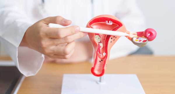 Polikistik Over Sendromu (PKOS) Nedir?